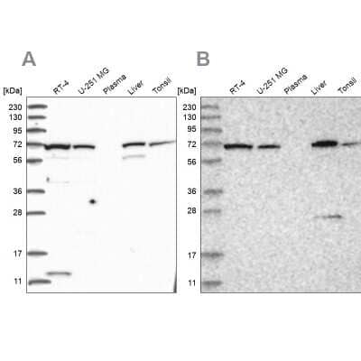 Western Blot: Aminopeptidase B/RNPEP Antibody [NBP1-85897]