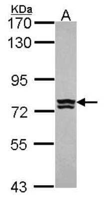 Western Blot: Aminopeptidase B/RNPEP Antibody [NBP2-20194]