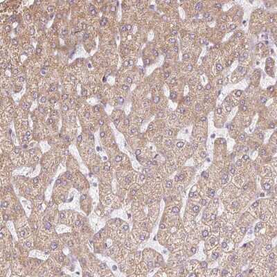 Immunohistochemistry: Aminopeptidase LRAP/ERAP2 Antibody [NBP2-37872]