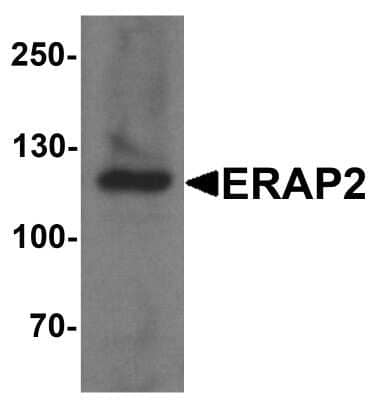 Western Blot: Aminopeptidase LRAP/ERAP2 AntibodyBSA Free [NBP2-81783]