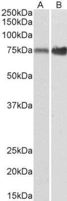 Western Blot: Aminopeptidase P1/XPNPEP1 Antibody [NBP1-51954]