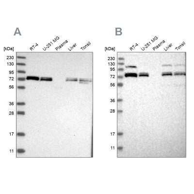 Western Blot: Aminopeptidase P1/XPNPEP1 Antibody [NBP1-80613]