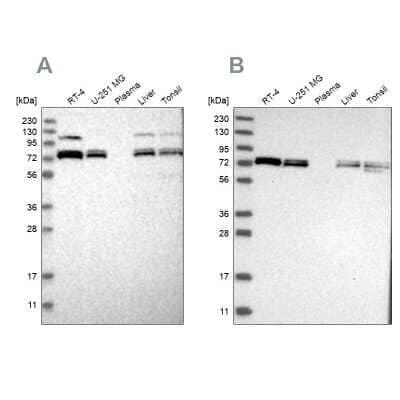 Western Blot: Aminopeptidase P1/XPNPEP1 Antibody [NBP1-80614]