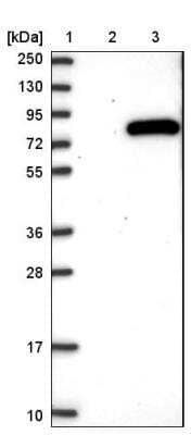 Western Blot: Aminopeptidase P1/XPNPEP1 Antibody [NBP1-80615]