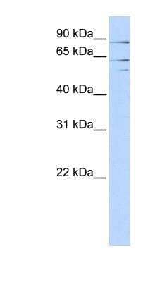 Western Blot: Aminopeptidase P2/XPNPEP2 Antibody [NBP1-80493]