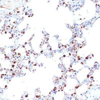 Immunohistochemistry-Paraffin: Aminopeptidase PILS/ARTS1 Antibody (6V8C0) [NBP3-16626]