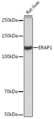 Western Blot: Aminopeptidase PILS/ARTS1 Antibody (6V8C0) [NBP3-16626]