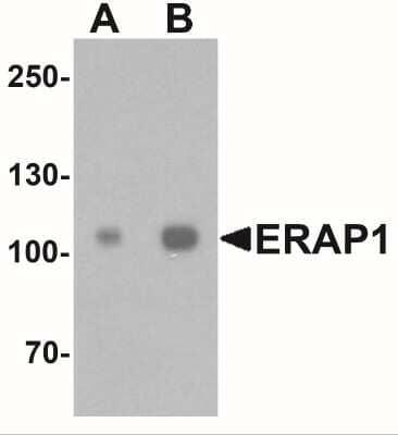 Western Blot: Aminopeptidase PILS/ARTS1 AntibodyBSA Free [NBP2-41232]