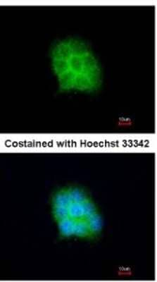 Immunocytochemistry/ Immunofluorescence: Amisyn Antibody [NBP2-15376]
