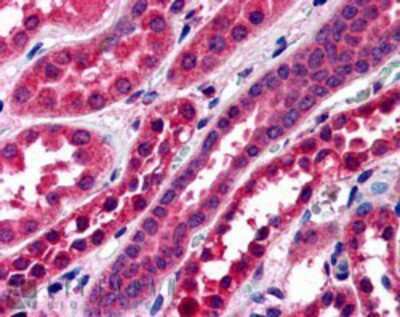 Immunohistochemistry: Amisyn Antibody [NB100-1227]