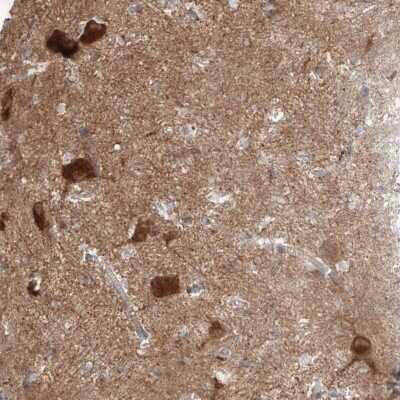 Immunohistochemistry-Paraffin: Amisyn Antibody [NBP1-90175]
