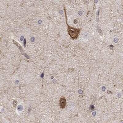 Immunohistochemistry-Paraffin: Amisyn Antibody [NBP3-17338]