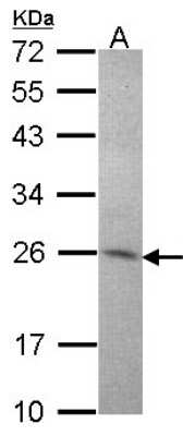 Western Blot: Amisyn Antibody [NBP2-15376]