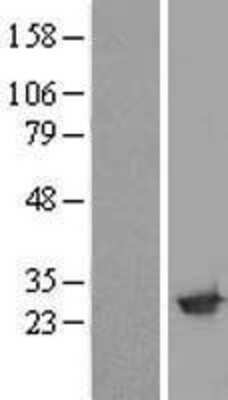 Western Blot: Amisyn Overexpression Lysate [NBL1-16589]