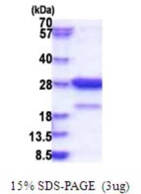 SDS-PAGE: Recombinant Human Amisyn His Protein [NBP2-51792]