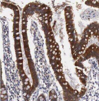 Immunohistochemistry-Paraffin: Amnionless/AMN Antibody [NBP1-91203]