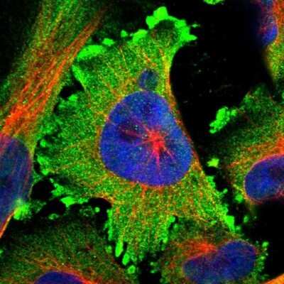 Immunocytochemistry/ Immunofluorescence: Amphiphysin/AMPH Antibody [NBP1-87561]
