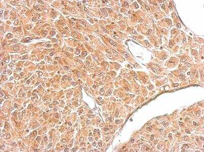 Immunohistochemistry: Amphiphysin/AMPH Antibody [NBP1-32505]