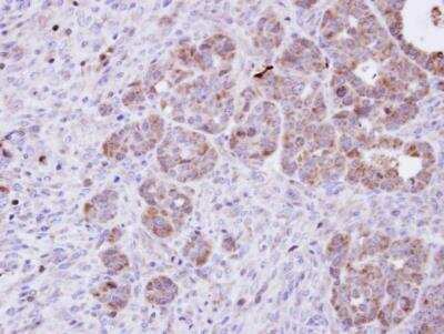Immunohistochemistry-Paraffin: Amphiphysin/AMPH Antibody [NBP1-32505]