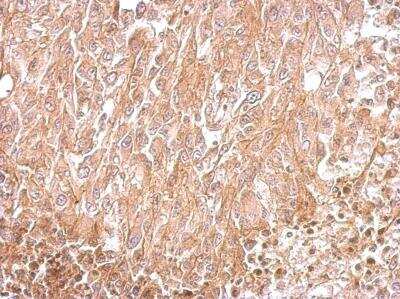 Immunohistochemistry-Paraffin: Amphiphysin/AMPH Antibody [NBP1-32505]