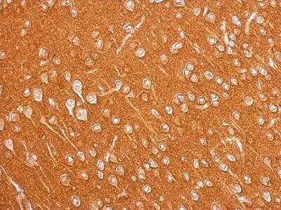 Immunohistochemistry-Paraffin: Amphiphysin/AMPH Antibody [NBP1-32505]