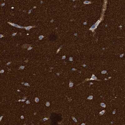 Immunohistochemistry-Paraffin: Amphiphysin/AMPH Antibody [NBP1-86033]