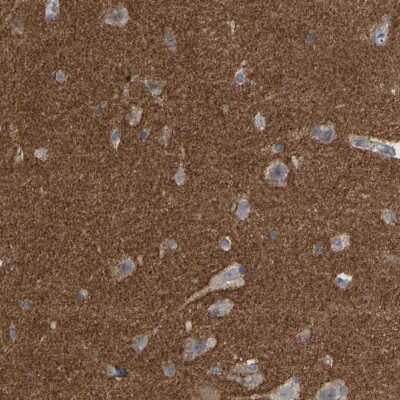 Immunohistochemistry-Paraffin: Amphiphysin/AMPH Antibody [NBP1-87561]