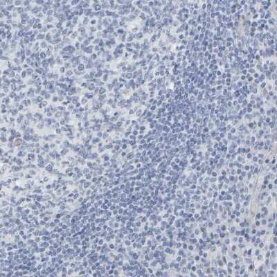 Immunohistochemistry-Paraffin: Amphiphysin/AMPH Antibody [NBP1-87561]