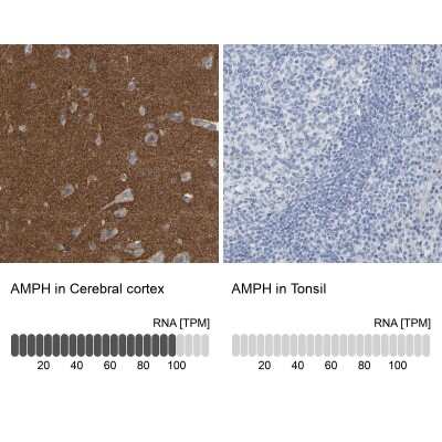 Immunohistochemistry-Paraffin: Amphiphysin/AMPH Antibody [NBP1-87561]