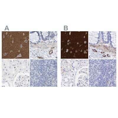 Immunohistochemistry-Paraffin: Amphiphysin/AMPH Antibody [NBP1-87561]