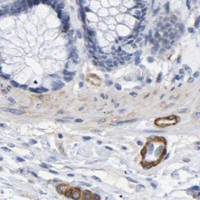 Immunohistochemistry-Paraffin: Amphiphysin/AMPH Antibody [NBP1-87561]