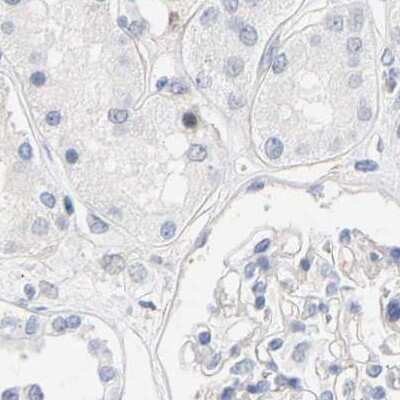 Immunohistochemistry-Paraffin: Amphiphysin/AMPH Antibody [NBP1-87561]