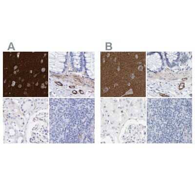 Western Blot: Amphiphysin/AMPH Antibody [NBP1-86033]