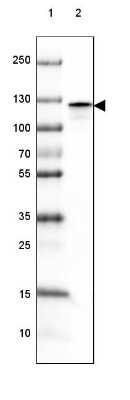 Western Blot: Amphiphysin/AMPH Antibody [NBP1-87561]