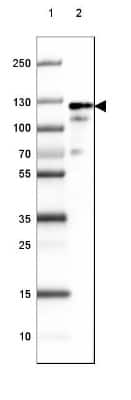 Western Blot: Amphiphysin/AMPH Antibody [NBP1-87561]