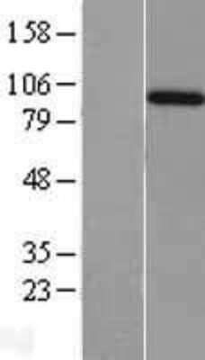 Western Blot: Amphiphysin/AMPH Overexpression Lysate [NBL1-07507]