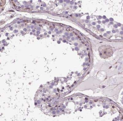 Immunohistochemistry-Paraffin: Amphiregulin Antibody [NBP1-87071]