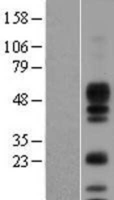 Western Blot: Amphiregulin Overexpression Lysate [NBL1-07648]