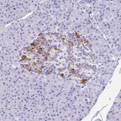 Immunohistochemistry: Amylin Antibody [NBP2-33680]