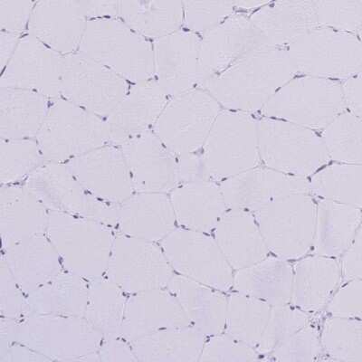Immunohistochemistry-Paraffin: Amylin Antibody [NBP2-33680]