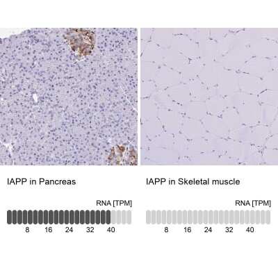 Immunohistochemistry-Paraffin: Amylin Antibody [NBP2-33680]