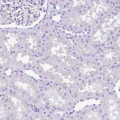 Immunohistochemistry-Paraffin: Amylin Antibody [NBP2-33680]
