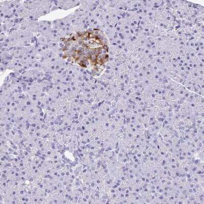 Immunohistochemistry-Paraffin: Amylin Antibody [NBP2-33680]