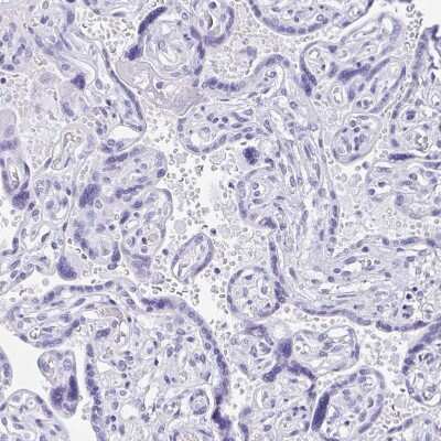 Immunohistochemistry-Paraffin: Amylin Antibody [NBP2-33680]