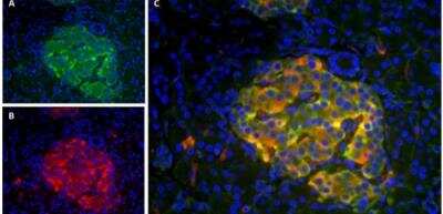 Immunocytochemistry/ Immunofluorescence: Amylin Antibody (R10/99) [NB600-713]