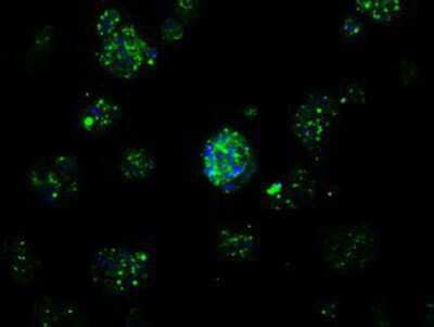 Immunocytochemistry/ Immunofluorescence: APP Antibody (OTI7G9) [NBP2-02358]