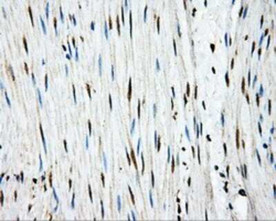 Immunohistochemistry-Paraffin: APP Antibody (OTI7G9) [NBP2-02358]
