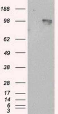 Western Blot: APP Antibody (OTI7G9) [NBP2-02358]