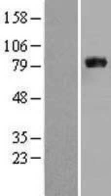 Western Blot: APP Overexpression Lysate [NBL1-07632]