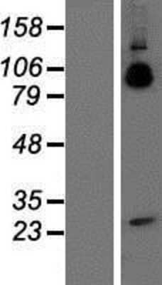 Western Blot: APP Overexpression Lysate [NBP2-04578]